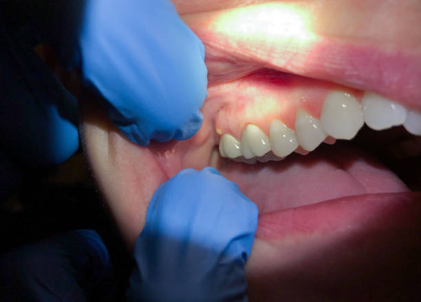Best Broken Tooth Emergency  in Mount Vernon, KY