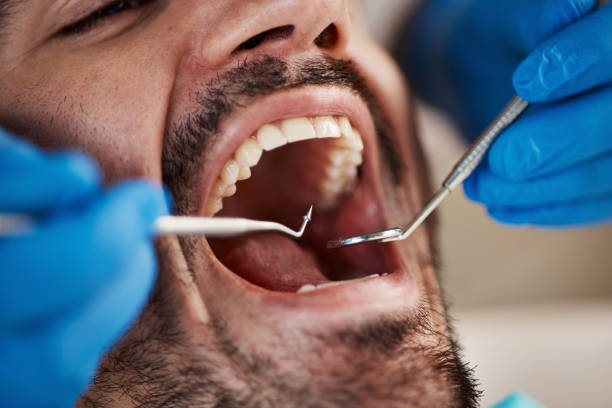Best Dentist for Tooth Abscess  in Mount Vernon, KY